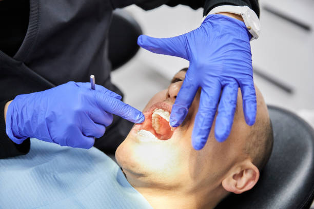 Best Emergency Wisdom Tooth Extraction in Yamhill, OR